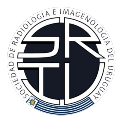 SRIU